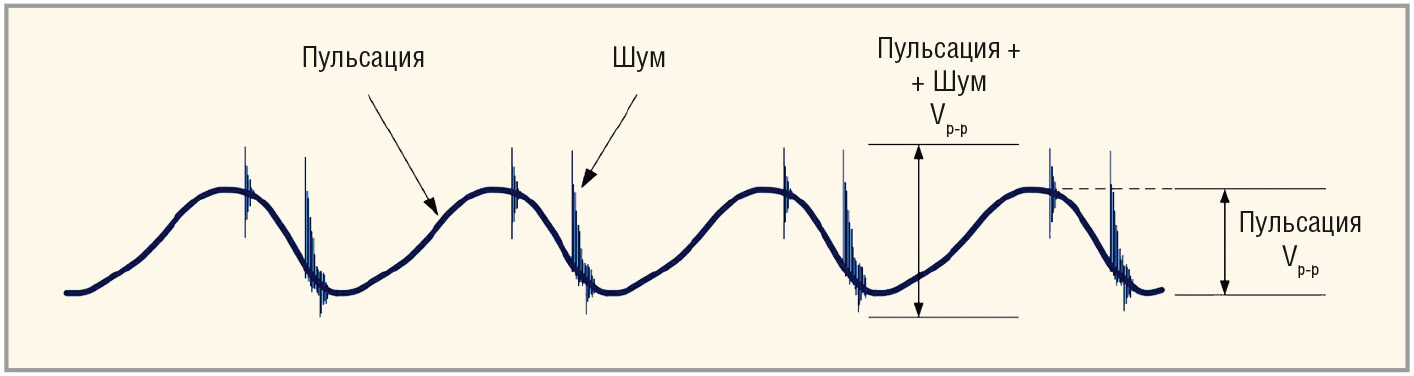 Рис. 5. Типичная форма сигнала пульсации выходного напряжения