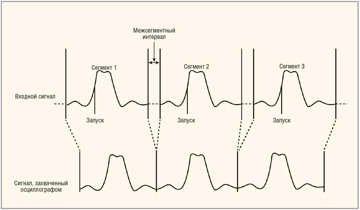 Рис. 1. Метод сегментированной памяти (полезные сигналы сохраняются в сегментах памяти)