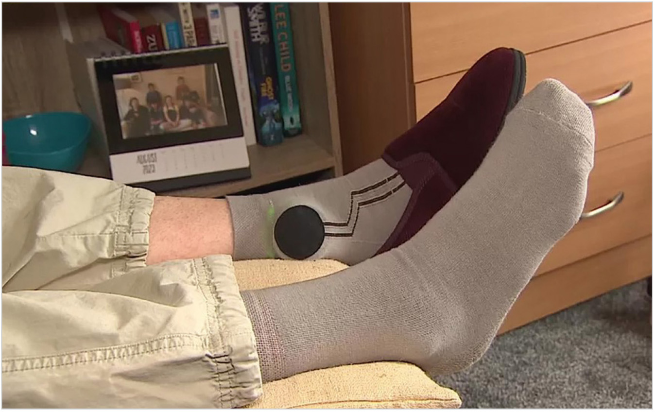 Рис. 2. Сенсорный датчик в носке