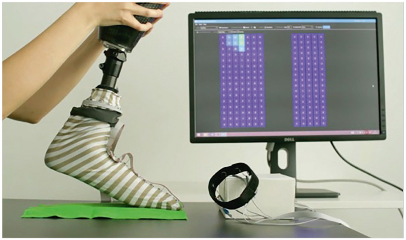 Рис. 3. Вид электронного носка с чувствительными датчиками для медицинского протеза
