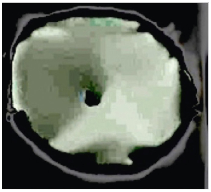 Рис. 9. Снимок светящейся пульсирующей плазмы тороидальной формы с ядром, движущимся вперед, полученный во время полёта STS-119